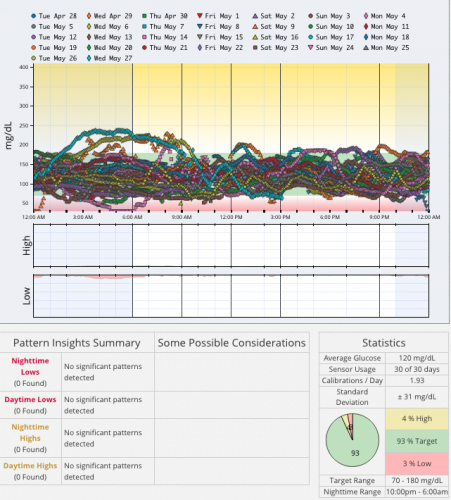 dexcom CGM for type1 diabetes